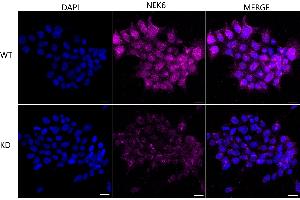 Immunocytochemical staining of HeLa cells using NEK6 antibody (ABIN7799603), 1:1,000), Top panel: wild-type (WT), Bottom panal: NEK6 shRNA knockdown (KD).