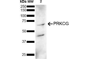 Western blot analysis of Mouse Brain showing detection of 78 kDa PRKCG protein using Rabbit Anti-PRKCG Polyclonal Antibody (ABIN5695960).