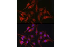 Immunofluorescence (IF) image for anti-Fascin (FSCN1) (AA 394-493) antibody (ABIN3023682)