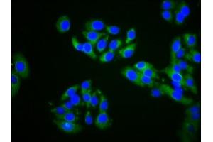 Immunofluorescence staining of HepG2 cells with ABIN7164570 at 1:200, counter-stained with DAPI. (ZDHHC14 Antikörper  (AA 328-453))