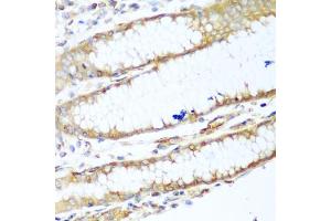 Immunohistochemistry of paraffin-embedded human stomach using MYH9 antibody. (Myosin 9 Antikörper)