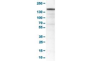Western Blot analysis of RT-4 cell lysates with MKL2 monoclonal antibody, clone CL1546 .