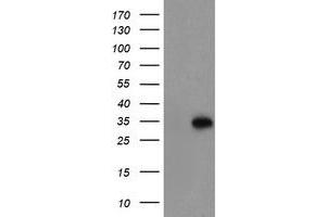 Western Blotting (WB) image for anti-Myeloid Leukemia Factor 1 (MLF1) antibody (ABIN1499498)