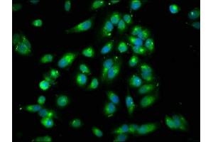 Immunofluorescence staining of Hela cells with ABIN7167994 at 1:250, counter-stained with DAPI. (ARHGEF7 Antikörper  (AA 1-250))