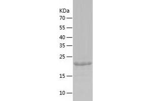 B-Cell CLL/lymphoma 7A (BCL7A) (AA 1-210) protein (His-IF2DI Tag)
