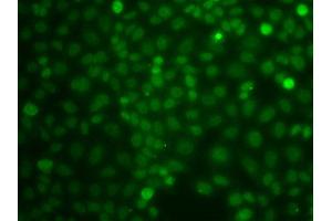 Immunofluorescence analysis of A549 cell using CBLC antibody. (CBLC Antikörper)