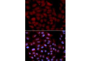Immunofluorescence analysis of U2OS cell using TNK2 antibody. (TNK2 Antikörper  (AA 70-385))