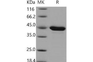 Western Blotting (WB) image for Protein Phosphatase, Mg2+/Mn2+ Dependent, 1A (PPM1A) protein (His tag) (ABIN7320335) (PPM1A Protein (His tag))