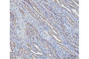 IHC analysis of Grp75 using anti-Grp75 antibody (ABIN7602782). (HSPA9 Antikörper  (C-Term))