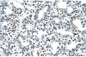 Human Lung; AKAP8L antibody - C-terminal region in Human Lung cells using Immunohistochemistry (AKAP8L Antikörper  (C-Term))