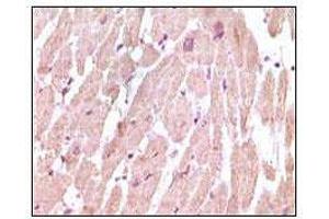 Immunohistochemical analysis of paraffin-embedded human normal cardiac muscle tissue, showing cytoplasmic localization using cTnI mouse mAb with DAB staining.