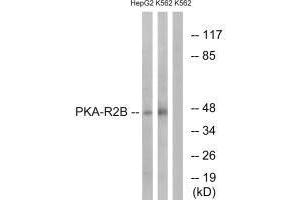 Western blot analysis of extracts from HepG2 cells and K562 cells, using PKA-R2β (Ab-113) antibody. (PRKAR2B Antikörper  (Ser113))