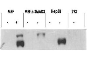 Western blot using SMAD3 (phospho S423/425) polyclonal antibody  shows detection of endogenous SMAD3 in stimulated cell lysates.