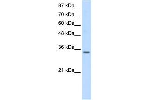 WB Suggested Anti-SNRPA Antibody Titration:  0. (SNRPA1 Antikörper  (Middle Region))