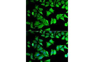 Immunofluorescence (IF) image for anti-Ribosomal Protein S12 (RPS12) (AA 1-132) antibody (ABIN6147195)