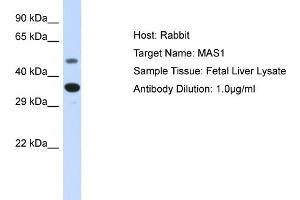 Host: Rabbit Target Name: MAS1 Sample Type: Fetal Liver lysates Antibody Dilution: 1.
