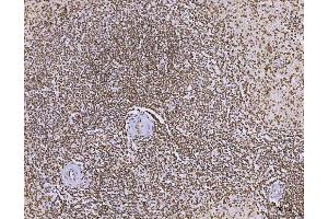 IHC analysis of C1orf77/FOP/CHTOP using anti-C1orf77/FOP/CHTOP antibody (ABIN7603201). (CHTOP Antikörper  (N-Term))