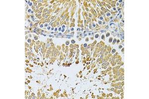 Immunohistochemistry of paraffin-embedded rat testis using PIBF1 Antibody. (PIBF1 Antikörper)