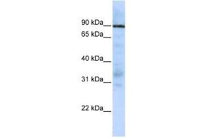 EWSR1 antibody used at 5 ug/ml to detect target protein.