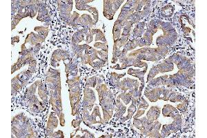 IHC analysis of DUSP6 using anti-DUSP6 antibody (ABIN7599332).