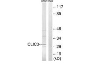 Western blot analysis of extracts from K562 cells, using CLIC3 Antibody. (CLIC3 Antikörper  (AA 21-70))