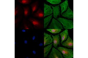 ABIN6264131 and ABIN6277486 staining  cells by IF/ICC. (PELP1 Antikörper  (Internal Region))