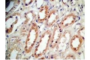 Immunohistochemistry (IHC) image for anti-Brain Natriuretic Peptide 45 (BNP-45) (AA 51-95) antibody (ABIN2871697)