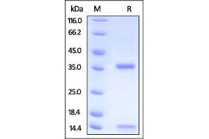 SDS-PAGE (SDS) image for neonatal Fc Receptor (FcRn) (AA 24-297) (Active) protein (His tag,Strep Tag,AVI tag,Biotin) (ABIN2870550)