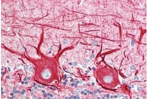 Human Brain, Cerebellum: Formalin-Fixed, Paraffin-Embedded (FFPE) (INA Antikörper)