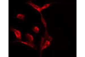 ABIN6275524 staining  HeLa cells by IF/ICC. (Septin 7 Antikörper  (C-Term))