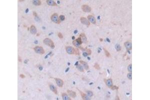 IHC-P analysis of Mouse Tissue, with DAB staining. (PLTP Antikörper  (AA 337-479))