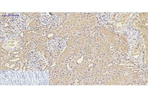 Immunohistochemistry of paraffin-embedded Human kidney tissue using IL8 Polyclonal Antibody at dilution of 1:200. (IL-8 Antikörper)