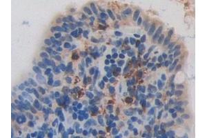 Immunohistochemistry (IHC) image for anti-Eosinophil Cationic Protein (ECP) (AA 33-155) antibody (ABIN7441835)