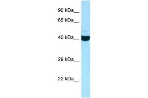 WB Suggested Anti-ADPRHL2 Antibody Titration: 1. (ADPRHL2 Antikörper  (C-Term))