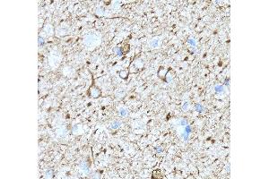 IHC analysis of Alpha Internexin/INA using anti-Alpha Internexin/INA antibody (ABIN7602187). (INA Antikörper  (AA 62-169))
