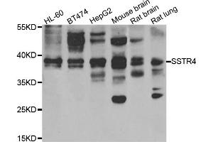 Western blot analysis of extracts of various cell lines, using SSTR4 antibody (ABIN5975458) at 1/1000 dilution. (SSTR4 Antikörper)