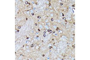 Immunohistochemistry of paraffin-embedded rat brain using Argonaute-2 antibody (ABIN7265671) at dilution of 1:100 (40x lens). (AGO2 Antikörper)