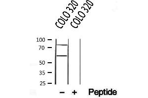Western blot analysis of extracts from COLO 320, using CREB3L1,OASIS antibody. (CREB3L1 Antikörper  (N-Term))
