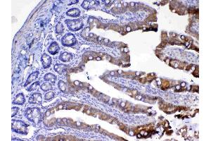 IHC analysis of UGT1A1 using anti-UGT1A1 antibody . (UGT1A1 Antikörper  (AA 316-533))