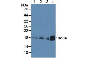 Figure. (TNNC1 Antikörper  (AA 1-161))