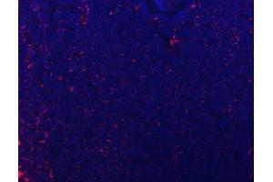 IF analysis of CD74 using anti-CD74 antibody (ABIN7602385). (CD74 Antikörper  (AA 73-296))