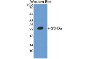 Western Blotting (WB) image for anti-Hemoglobin beta (HBB) (AA 1-147) antibody (ABIN2116576) (Hemoglobin Subunit beta Antikörper  (AA 1-147))