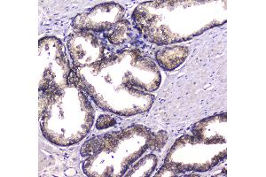 IHC analysis of HGD using anti-HGD antibody . (HGD Antikörper  (AA 374-445))