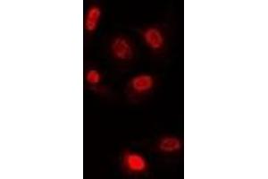 Immunofluorescent analysis of TLE1 staining in U2OS cells.
