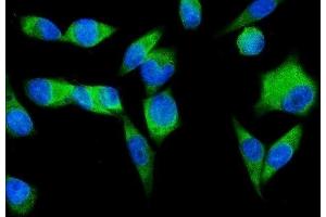 IF analysis of SND1 using anti-SND1 antibody (ABIN7600525). (SND1 Antikörper  (AA 20-204))