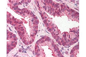 Anti-TMED10 / TMP21 antibody IHC of human prostate. (TMED10 Antikörper  (C-Term))