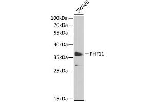 Western blot analysis of extracts of SW480 cells, using PHF11 antibody (ABIN6290738) at 1:1000 dilution. (PHF11 Antikörper)
