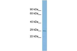 WB Suggested Anti-CHCHD3 Antibody Titration: 0. (CHCHD3 Antikörper  (Middle Region))