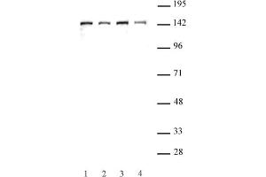 SMC3 antibody (pAb) tested by Western blot. (SMC3 Antikörper  (C-Term))