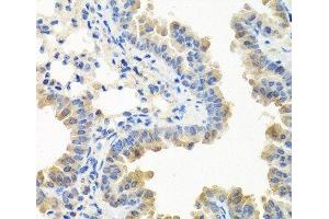 Immunohistochemistry of paraffin-embedded Mouse lung using LRG1 Polyclonal Antibody at dilution of 1:100 (40x lens). (LRG1 Antikörper)
